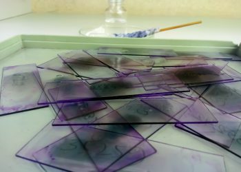 Morfologia ematologica su striscio di sangue venoso periferico e rischio clinico