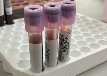 Risultati inaffidabili dell’esame emocromocitometrico: cause, riconoscimento e risoluzioni