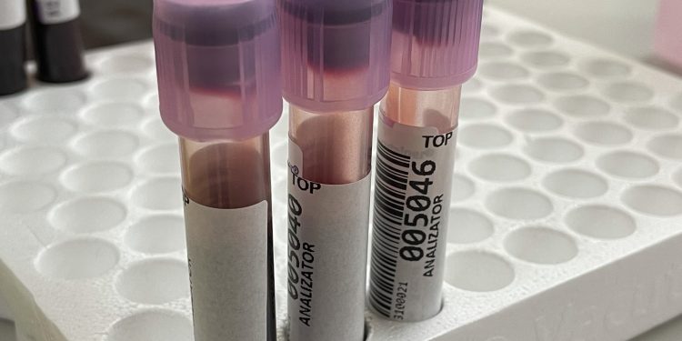 Risultati inaffidabili dell’esame emocromocitometrico: cause, riconoscimento e risoluzioni